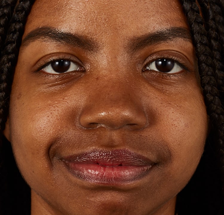 complexion before